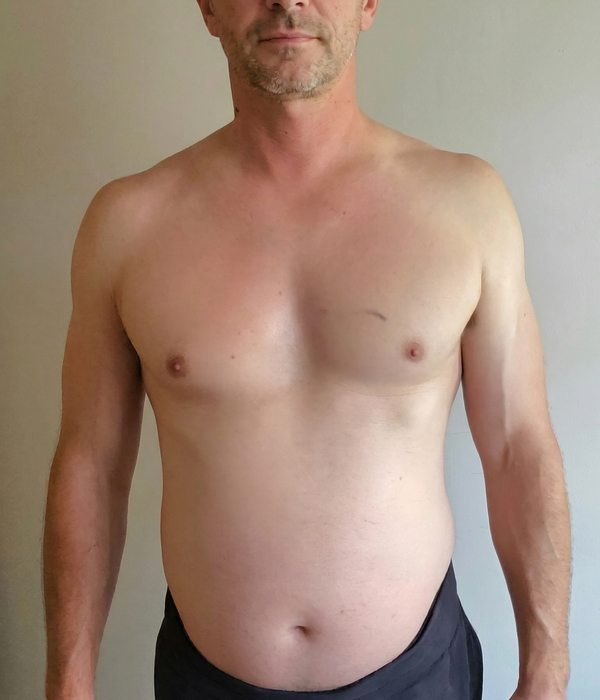 Before - David R.